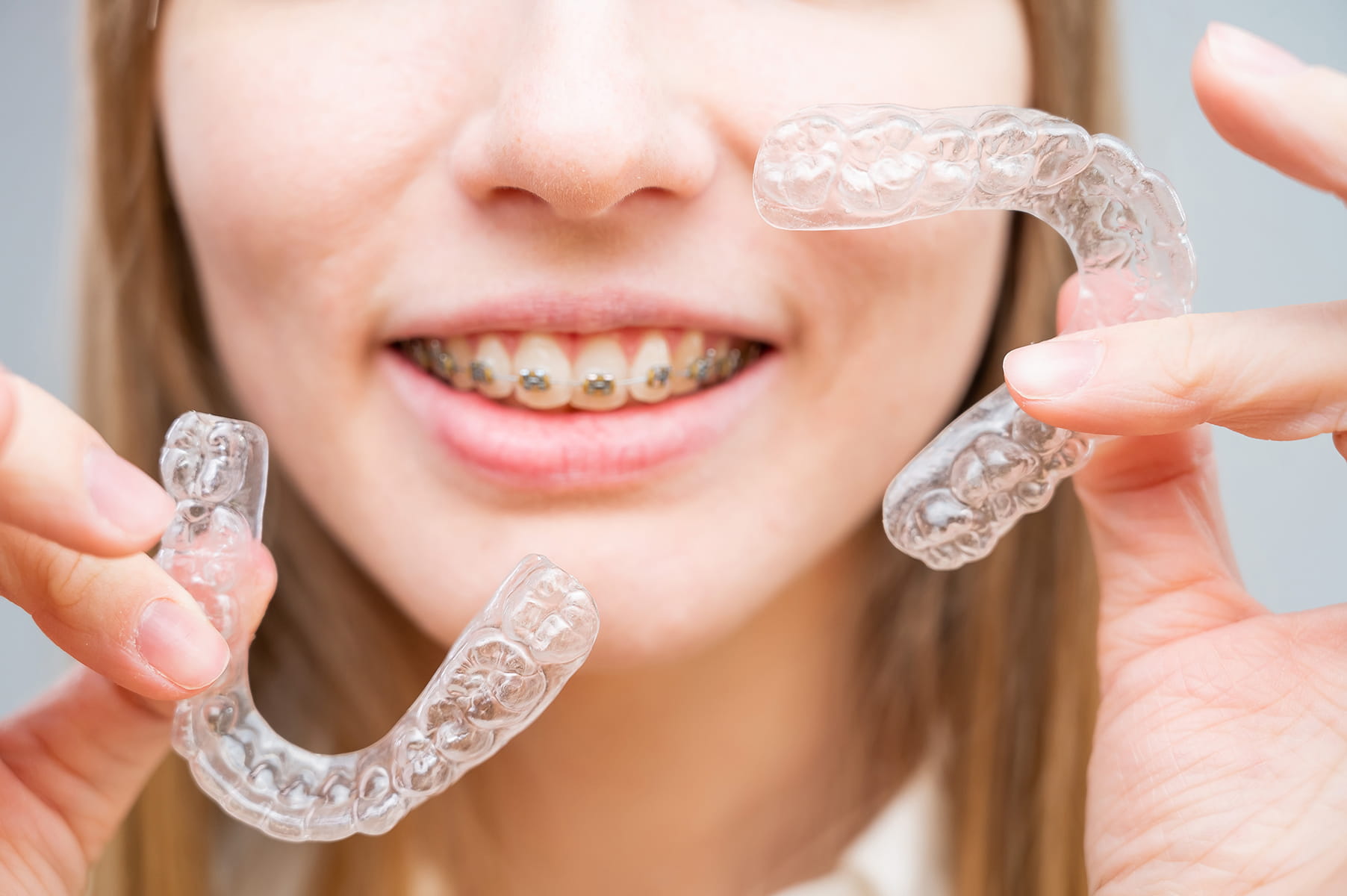 Clear aligners dentist in Windsor, CO