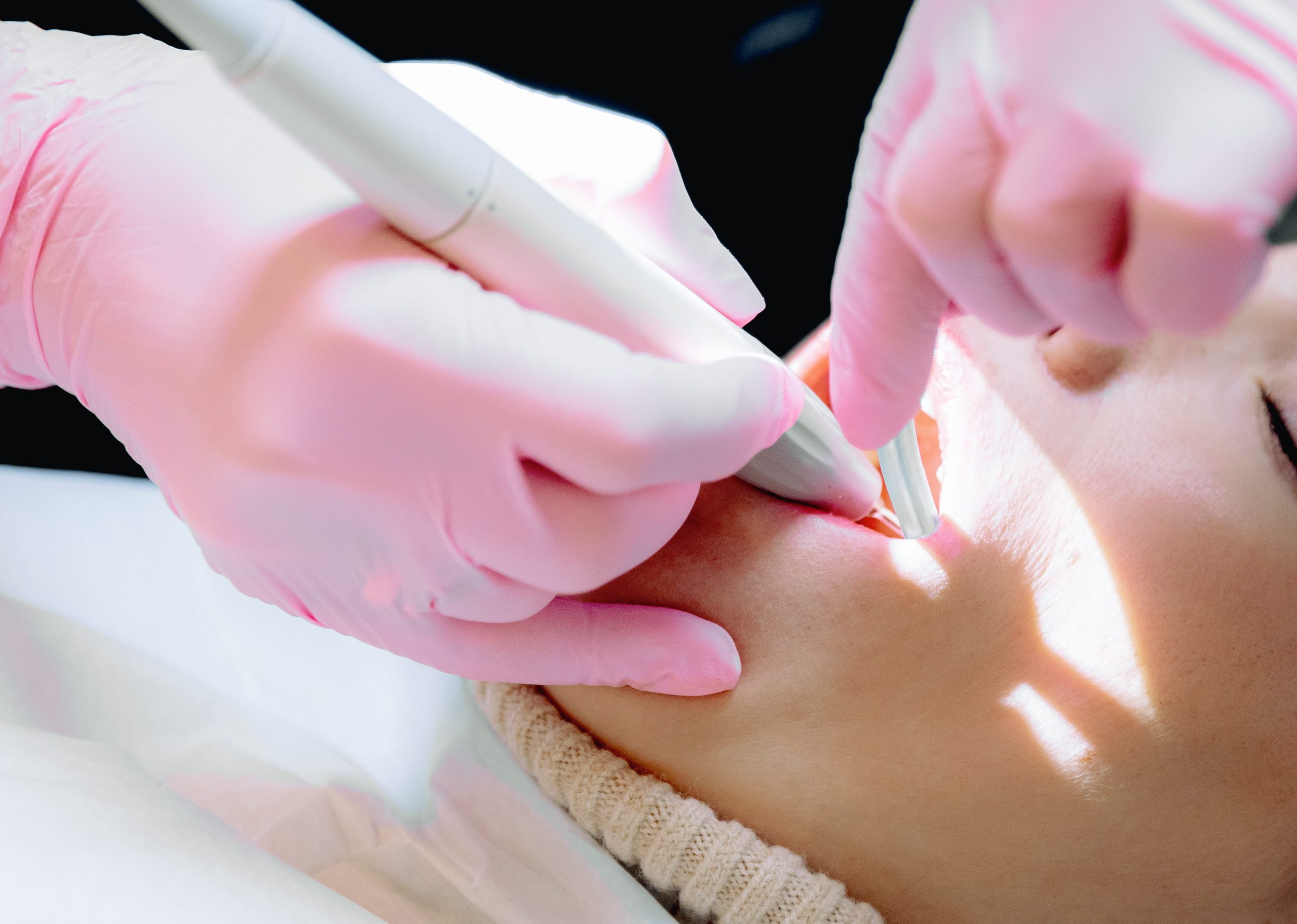 Laser gum treatment in Windsor, CO